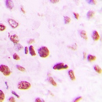 SMAD6 Rabbit Polyclonal Antibody