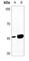 MAGEA1 Rabbit Polyclonal Antibody