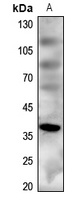 MC4 Receptor Rabbit Polyclonal Antibody