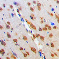 MC4 Receptor Rabbit Polyclonal Antibody