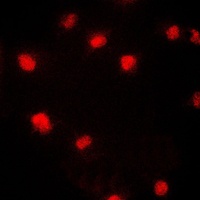 CDC46 Rabbit Polyclonal Antibody