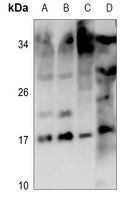 Mammaglobin B Rabbit Polyclonal Antibody