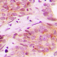 Mammaglobin B Rabbit Polyclonal Antibody