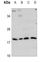 Mammaglobin A Rabbit Polyclonal Antibody