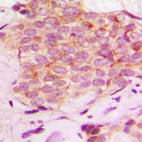 Mammaglobin A Rabbit Polyclonal Antibody