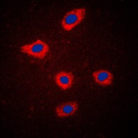 Mammaglobin A Rabbit Polyclonal Antibody