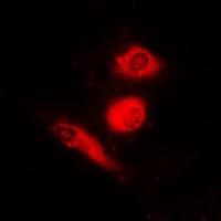 FOXO4 (Phospho-S197) Rabbit Polyclonal Antibody