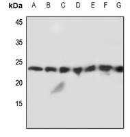 MMP1 22k Rabbit Polyclonal Antibody