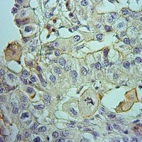 MMP1 22k Rabbit Polyclonal Antibody