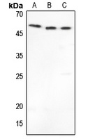 MMP1 Rabbit Polyclonal Antibody