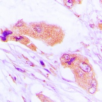 MMP1 Rabbit Polyclonal Antibody