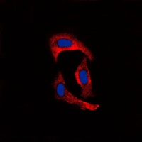 MMP1 Rabbit Polyclonal Antibody