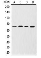 MMP2 Rabbit Polyclonal Antibody