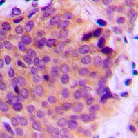 MMP2 Rabbit Polyclonal Antibody