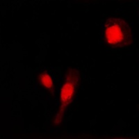 MMP2 Rabbit Polyclonal Antibody