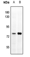 MMP9 Rabbit Polyclonal Antibody