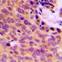MMP9 Rabbit Polyclonal Antibody