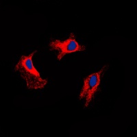 MMP9 Rabbit Polyclonal Antibody