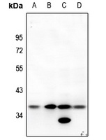 MT-ND1 Rabbit Polyclonal Antibody