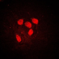 c-Myc (Phospho-S62) Rabbit Polyclonal Antibody