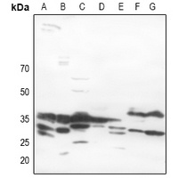 MYD88 Rabbit Polyclonal Antibody