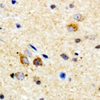 MYD88 Rabbit Polyclonal Antibody
