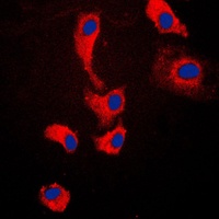 MYD88 Rabbit Polyclonal Antibody