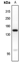 MYO6 Rabbit Polyclonal Antibody