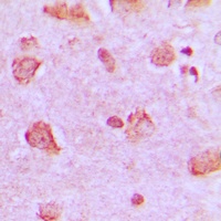 NDUFA4 Rabbit Polyclonal Antibody