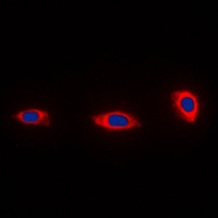 NDUFA4 Rabbit Polyclonal Antibody
