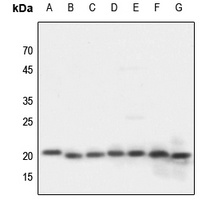 NDUFA8 Rabbit Polyclonal Antibody