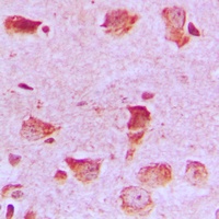 NDUFA8 Rabbit Polyclonal Antibody