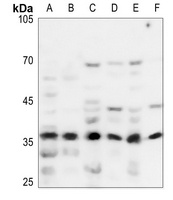 NDUFA9 Rabbit Polyclonal Antibody