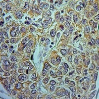 NDUFA9 Rabbit Polyclonal Antibody