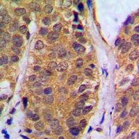 NF-kappaB p105 (Phospho-S927) Rabbit Polyclonal Antibody