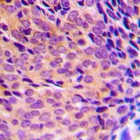 NF-kappaB p105/p50 (Phospho-S337) Rabbit Polyclonal Antibody