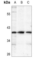 IKB alpha (Phospho-S32/S36) Rabbit Polyclonal Antibody