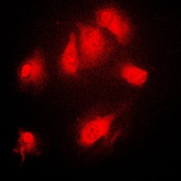 IKB alpha (Phospho-S32/S36) Rabbit Polyclonal Antibody
