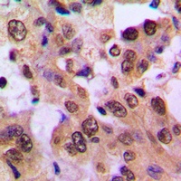 IKB beta (Phospho-S23) Rabbit Polyclonal Antibody
