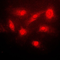 IKB beta (Phospho-S23) Rabbit Polyclonal Antibody