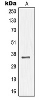 NKX3-1 Rabbit Polyclonal Antibody