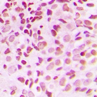 NKX3-1 Rabbit Polyclonal Antibody
