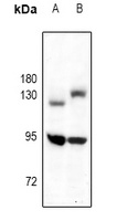 TRK B Rabbit Polyclonal Antibody