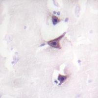 TRK B Rabbit Polyclonal Antibody
