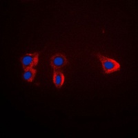 TRK B Rabbit Polyclonal Antibody