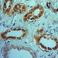 RKIP Rabbit Polyclonal Antibody