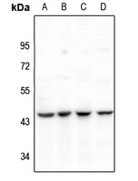 PAI2 Rabbit Polyclonal Antibody