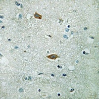 PAI2 Rabbit Polyclonal Antibody