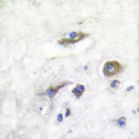 Parkin Rabbit Polyclonal Antibody