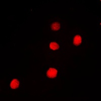 PAX9 Rabbit Polyclonal Antibody